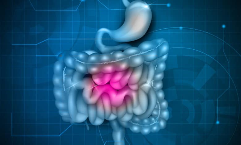 intestino infiammato