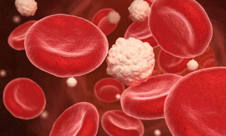 intolleranza al glucosio