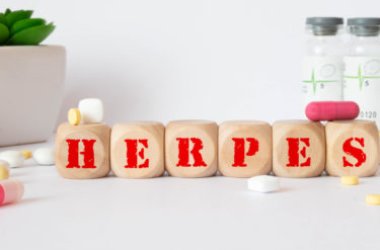 Tutto sull’herpes zoster, meglio noto come fuoco di Sant’Antonio