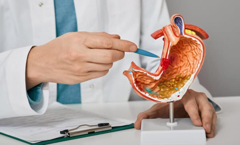 reflusso gastroesofageo