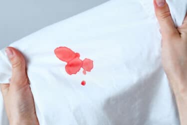 Come togliere le macchie di sangue: i vari casi