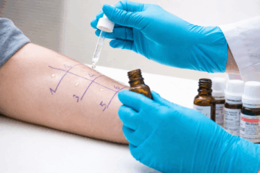 Test delle intolleranze alimentari: a cosa serve e su quali principi si basa